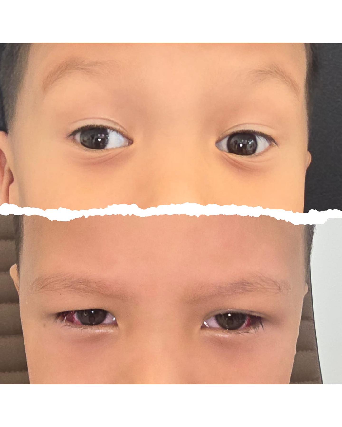 До и после операции