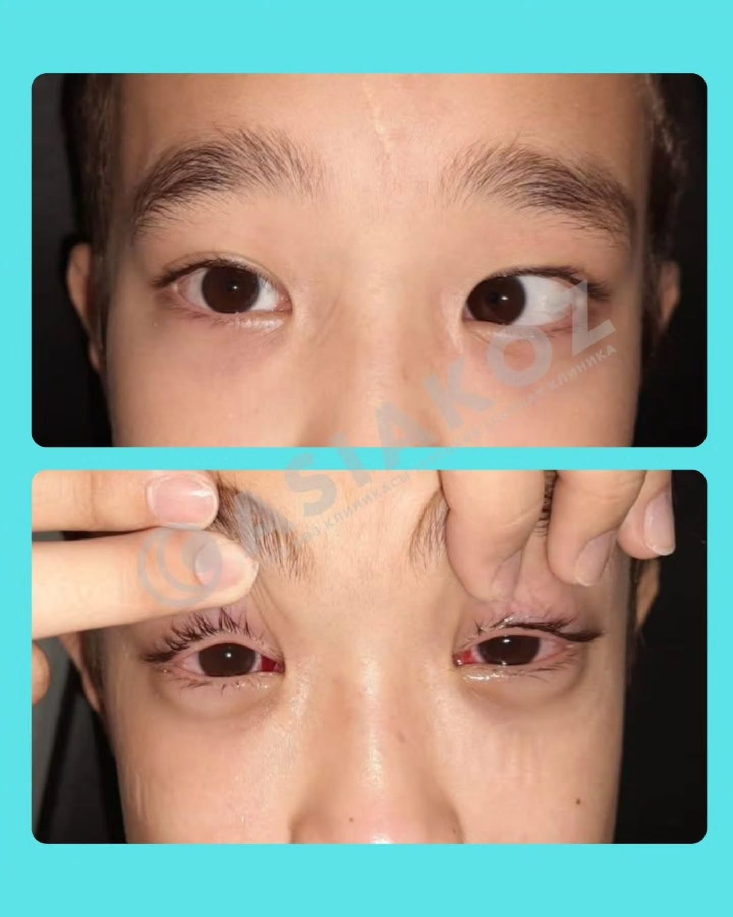 До и после операции