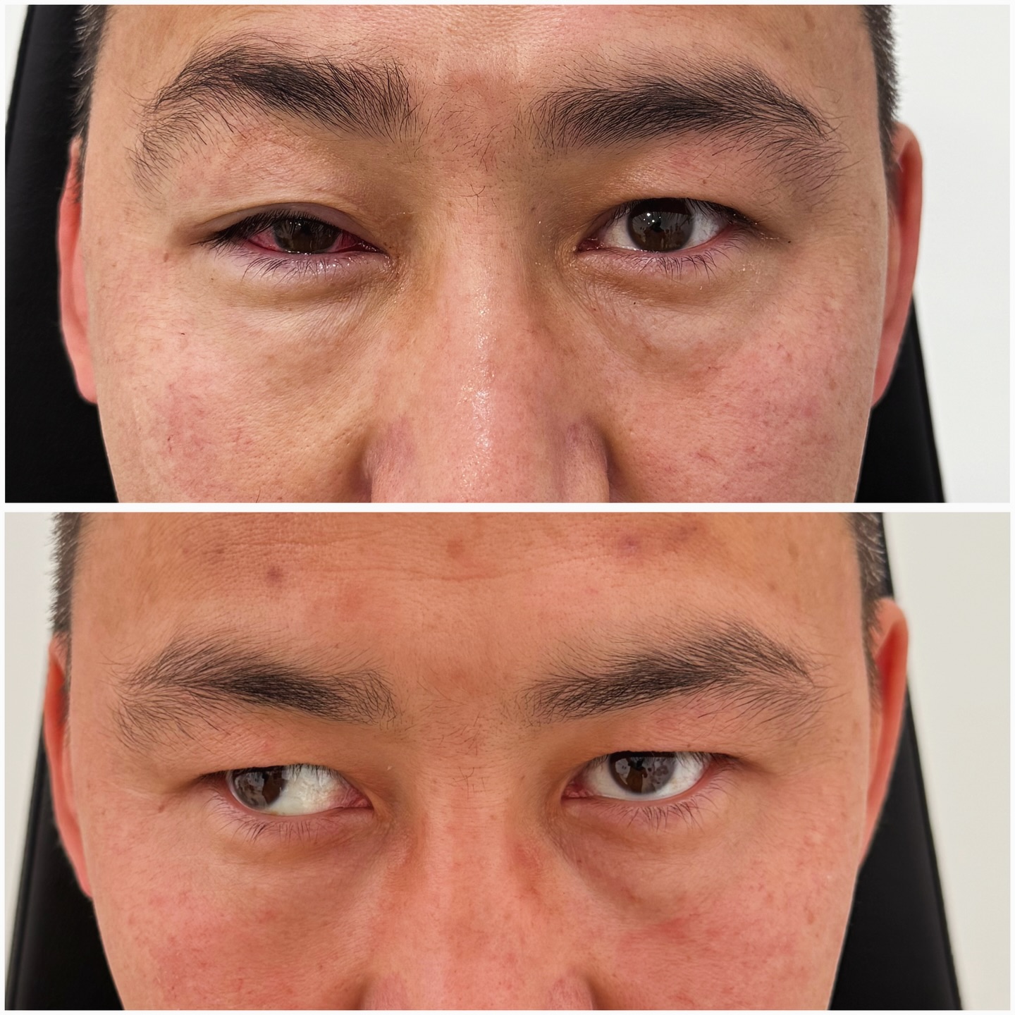 До и после операции