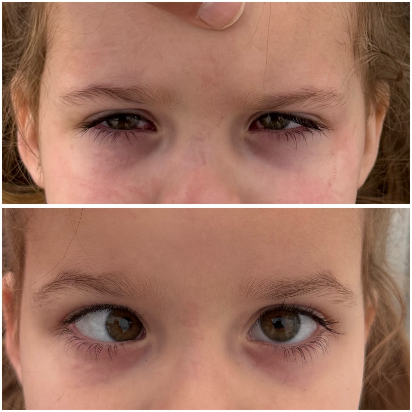 До и после операции