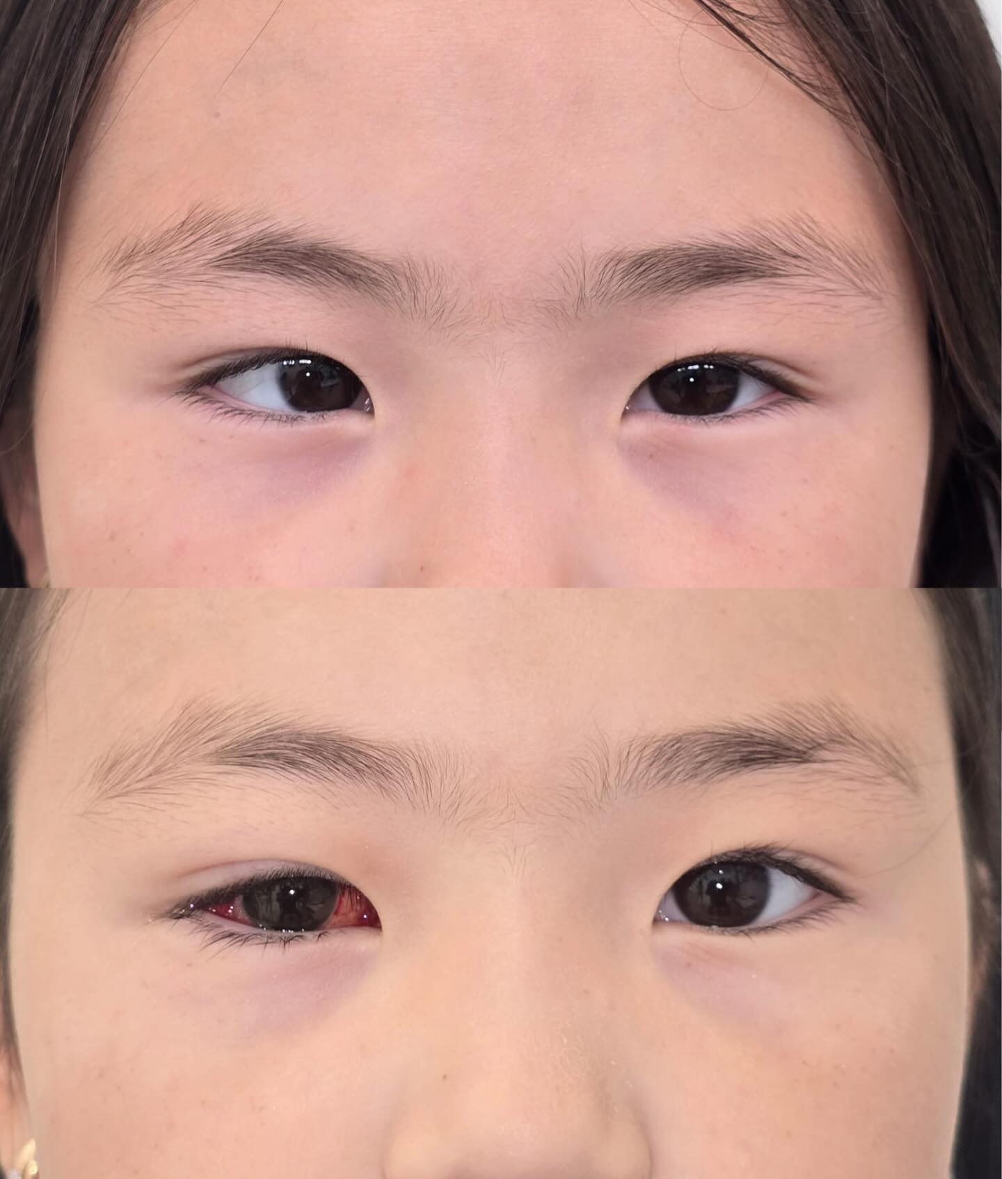 До и после операции