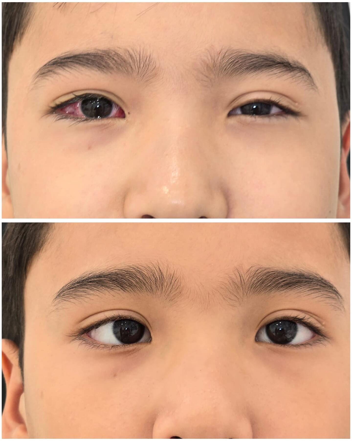 До и после операции