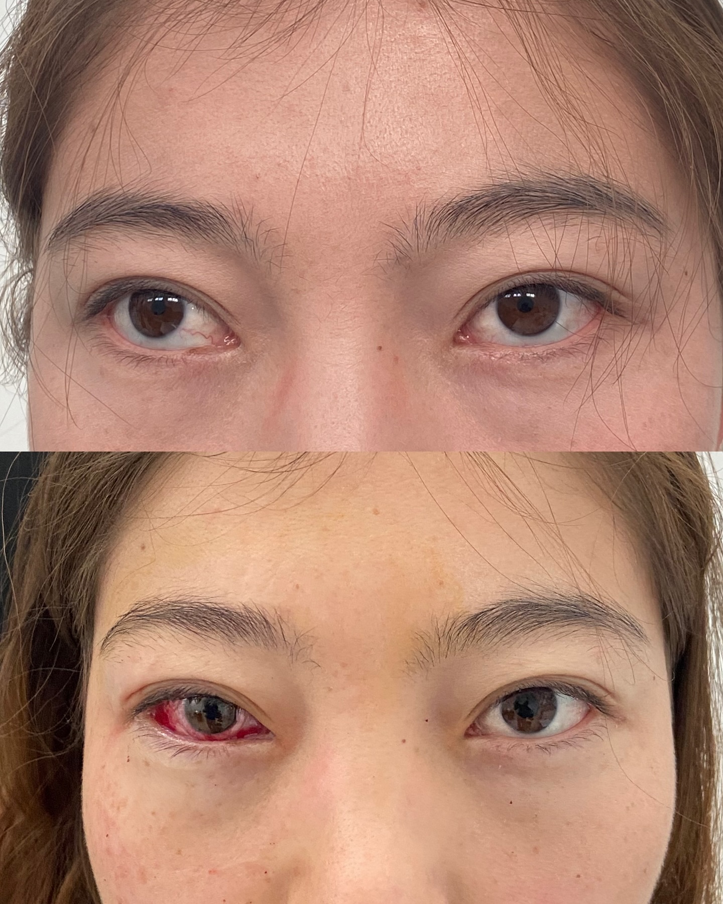 До и после операции