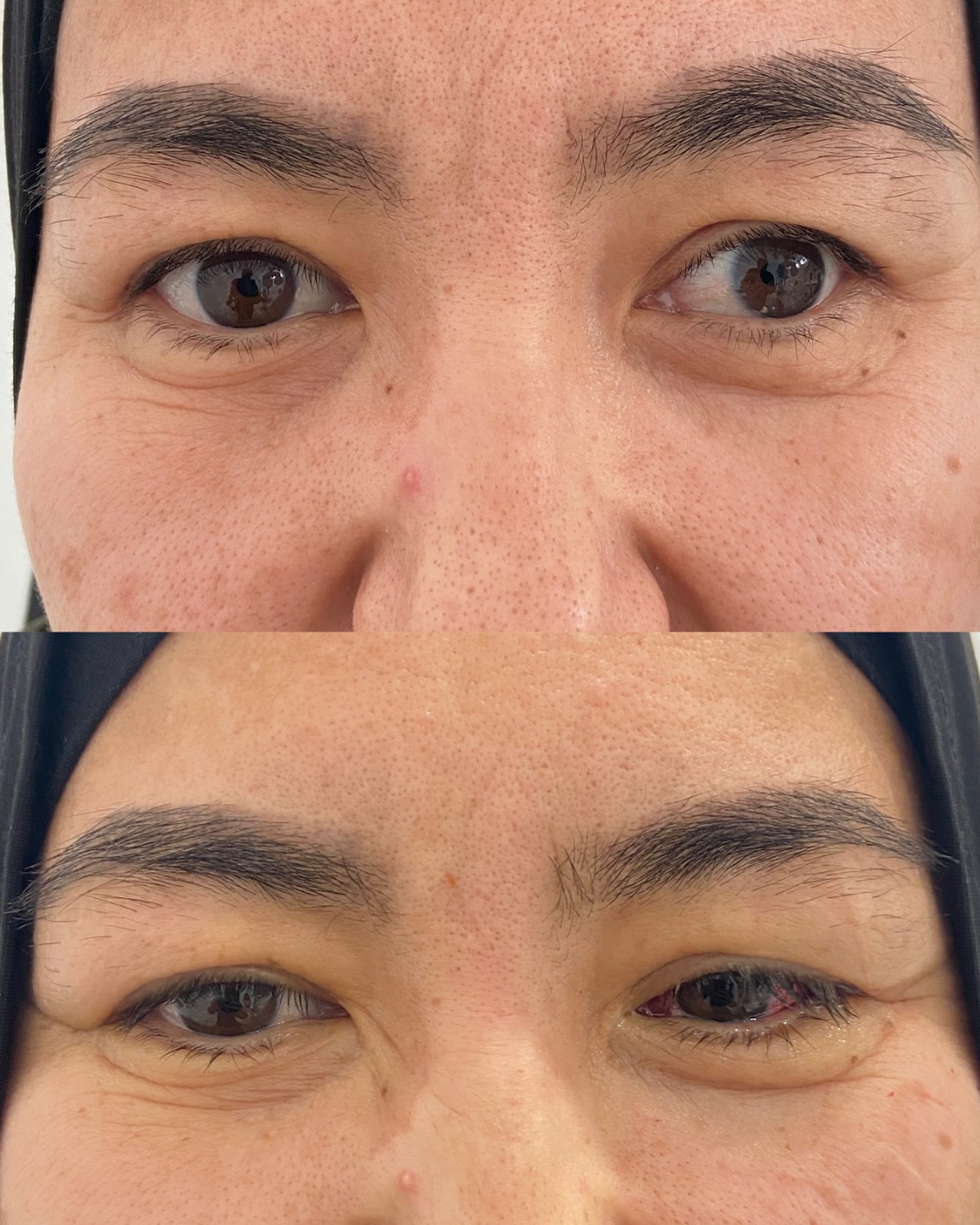 До и после операции