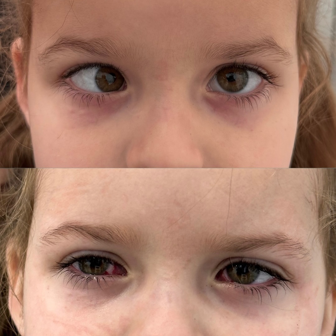 До и после операции