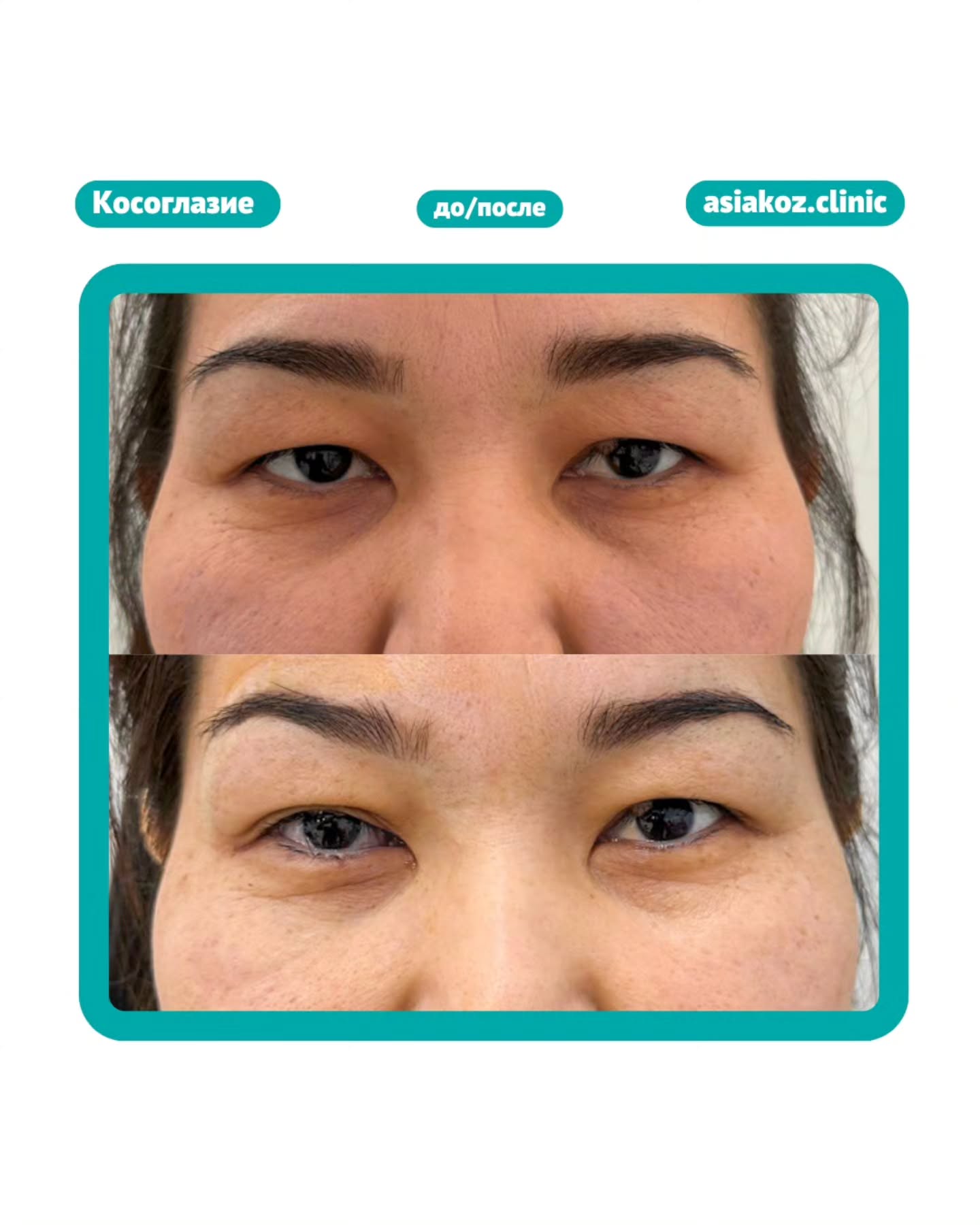 До и после операции