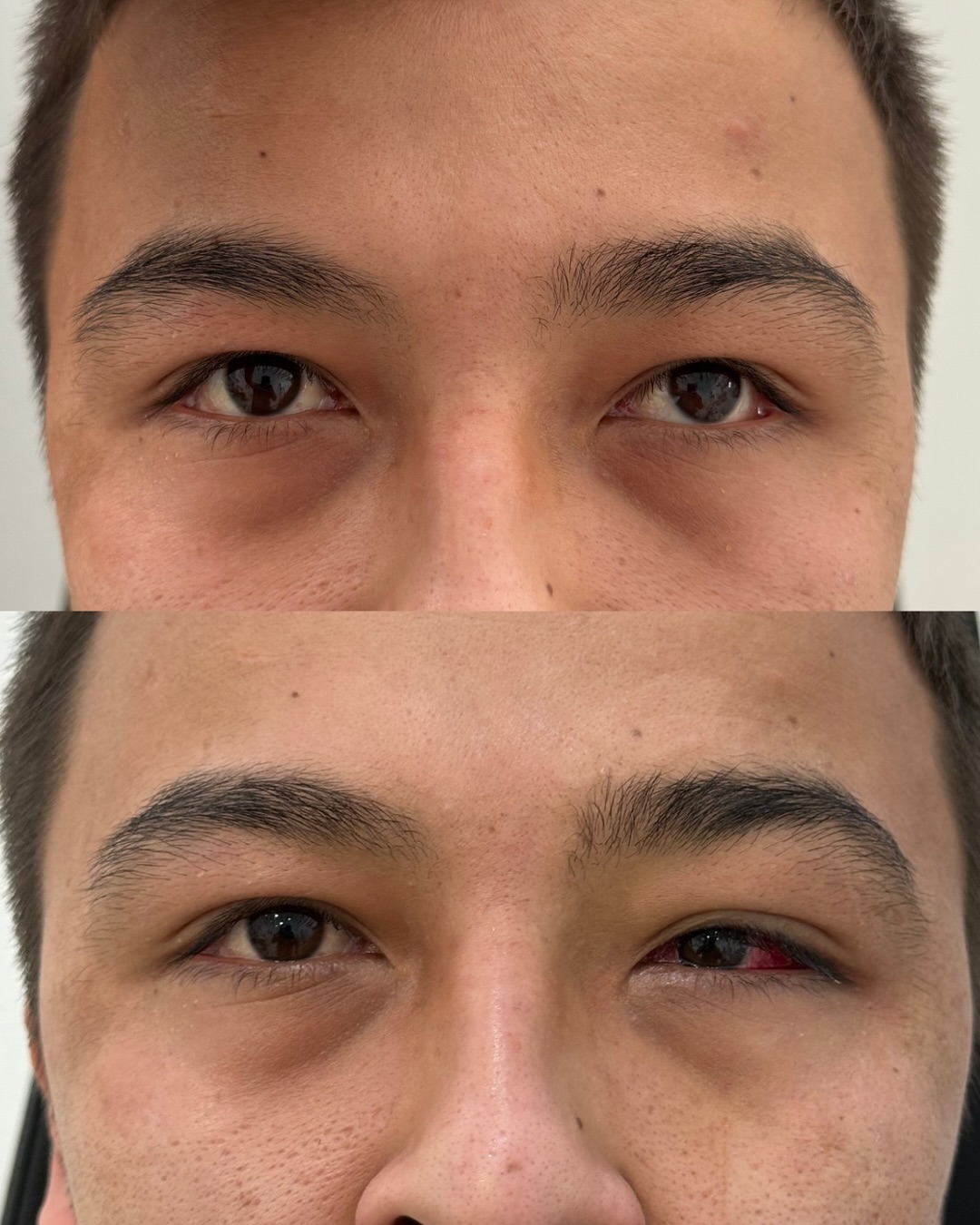 До и после операции