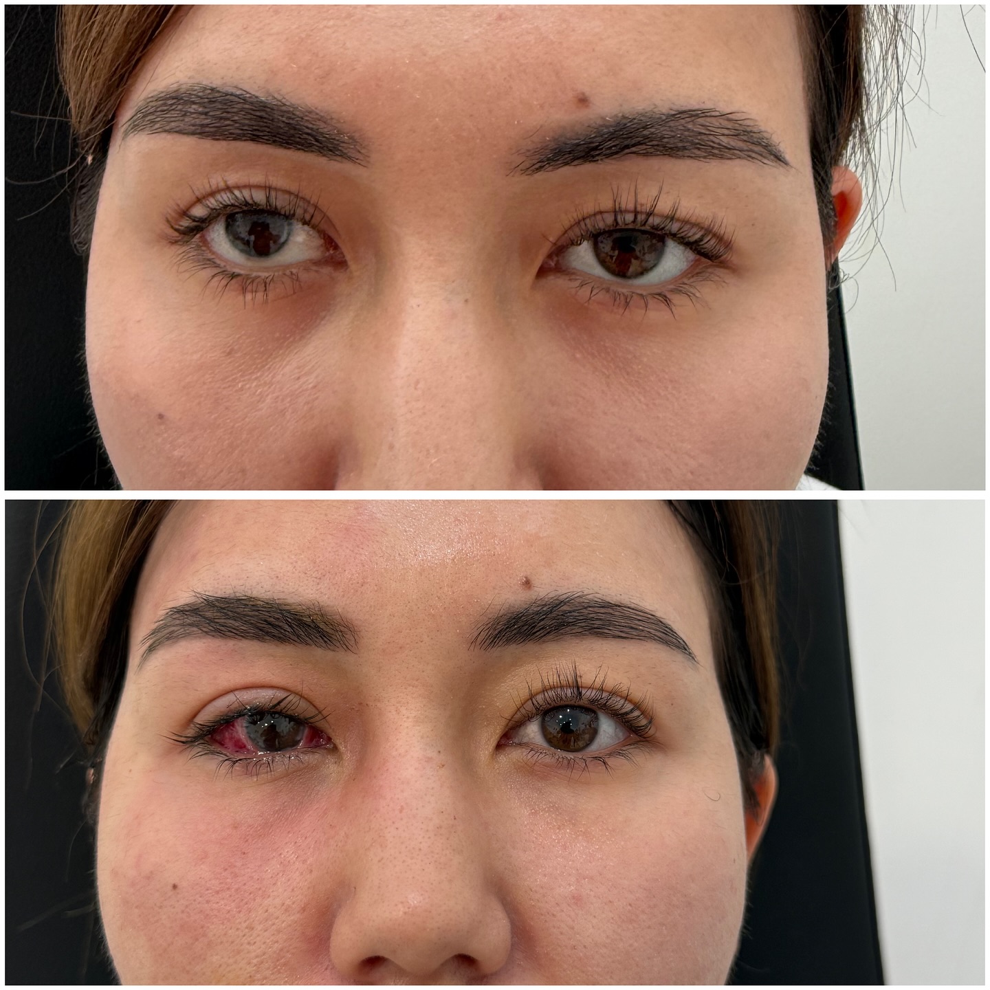 До и после операции